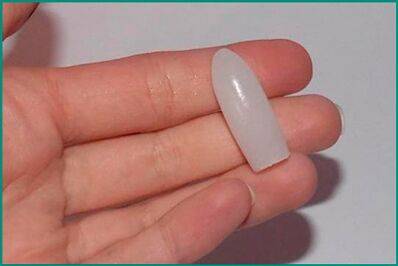 Suppositorien fir d'Behandlung vu Cystitis bei Fraen a Männer